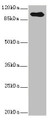 Western blot; All lanes: TGFBR3 antibody IgG at 2.39µg/ml + Hela whole cell lysate; Secondary; Goat polyclonal to rabbit IgG at 1/10000 dilution; Predicted band size: 93 kDa; Observed band size: 93 kDa;