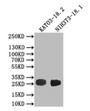 Western blot; All lanes: CLDN18 antibody IgG at 3.07µg/ml + Rat heart tissue; Secondary; Goat polyclonal to rabbit IgG at 1/10000 dilution; Predicted band size: 28 kDa; Observed band size: 28 kDa;