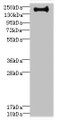 Western blot; All lanes: VSX1 antibody IgG at 0.87µg/ml + Hela whole cell lysate; Secondary; Goat polyclonal to rabbit IgG at 1/10000 dilution; Predicted band size: 159, 154, 153, 152, 151, 147, 160 kDa; Observed band size: 159 kDa;