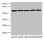 Western blot; All lanes: ARHGEF3 antibody at 2.21µg/ml; Lane 1: MCF-7 whole cell lysate; Lane 2: HepG2 whole cell lysate; Lane 3: Jurkat whole cell lysate; Lane 4: Hela whole cell lysate; Lane 5: 293T whole cell lysate; Secondary; Goat polyclonal to rabbit IgG at 1/10000 dilution; Predicted band size: 60, 64, 61, 37 kDa; Observed band size: 60 kDa