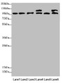 Western blot; All lanes: NAA25 antibody at 2.12µg/ml; Lane 1: Mouse liver tissue; Lane 2: Mouse kidney tissue; Lane 3: Hela whole cell lysate; Lane 4: 293T whole cell lysate; Lane 5: A549 whole cell lysate; Lane 6: HepG2 whole cell lysate; Secondary; Goat polyclonal to rabbit IgG at 1/10000 dilution; Predicted band size: 113, 100 kDa; Observed band size: 113, 100 kDa