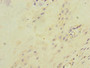 Immunohistochemistry of paraffin-embedded human placenta tissue using CAC10915 at dilution of 1:100 Immunohistochemistry of paraffin-embedded human placenta tissue using CAC10915 at dilution of 1:100