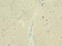 Immunohistochemistry of paraffin-embedded human brain tissue using CAC10916 at dilution of 1:100