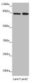 Western blot; All lanes: NELL1 antibody at 4.52µg/ml; Lane 1: Hela whole cell lysate; Lane 2: Jurkat whole cell lysate; Secondary; Goat polyclonal to rabbit IgG at 1/10000 dilution; Predicted band size: 90, 85 kDa; Observed band size: 85 kDa