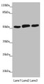 Western blot; All lanes: CRBN antibody at 4.65µg/ml; Lane 1: Mouse liver tissue; Lane 2: Colo320 whole cell lysate; Lane 3: A375 whole cell lysate; Secondary; Goat polyclonal to rabbit IgG at 1/10000 dilution; Predicted band size: 51 kDa; Observed band size: 51 kDa