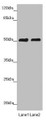 Western blot; All lanes: CRBN antibody at 5.28µg/ml; Lane 1: Mouse liver tissue; Lane 2: A375 whole cell lysate; Secondary; Goat polyclonal to rabbit IgG at 1/10000 dilution; Predicted band size: 51 kDa; Observed band size: 51 kDa Western blot; All lanes: CRBN antibody at 5.28µg/ml; Lane 1: Mouse liver tissue; Lane 2: A375 whole cell lysate; Secondary; Goat polyclonal to rabbit IgG at 1/10000 dilution; Predicted band size: 51 kDa; Observed band size: 51 kDa