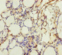 Immunohistochemistry of paraffin-embedded human thyroid tissue using CAC10921 at dilution of 1:100 Immunohistochemistry of paraffin-embedded human thyroid tissue using CAC10921 at dilution of 1:100