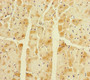 Immunohistochemistry of paraffin-embedded human heart tissue using CAC10928 at dilution of 1:100
