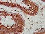 IHC image diluted at 1:700 and staining in paraffin-embedded human testis tissue performed on a Leica BondTM system. After dewaxing and hydration, antigen retrieval was mediated by high pressure in a citrate buffer (pH 6.0). Section was blocked with 10% normal goat serum 30min at RT. Then primary antibody (1% BSA) was incubated at 4°C overnight. The primary is detected by a biotinylated secondary antibody and visualized using an HRP conjugated SP system.