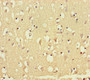 Immunohistochemistry of paraffin-embedded human brain tissue using CAC10956 at dilution of 1:100