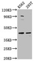Western Blot; Positive WB detected in: K562 whole cell lysate, 293T whole cell lysate; All lanes: XKR8 antibody at 3.4µg/ml; Secondary; Goat polyclonal to rabbit IgG at 1/50000 dilution; Predicted band size: 45 kDa; Observed band size: 45 kDa