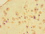 Immunohistochemistry of paraffin-embedded human placenta tissue using CAC10971 at dilution of 1:100