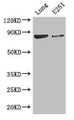 Western Blot; Positive WB detected in: Mouse lung tissue, U251 whole cell lysate; All lanes: YTHDC1 antibody at 3.4µg/ml; Secondary; Goat polyclonal to rabbit IgG at 1/50000 dilution; Predicted band size: 85, 83 kDa; Observed band size: 85 kDa;