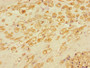 Immunohistochemistry of paraffin-embedded human placental tissue using CAC10976 at dilution of 1:100