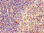 Immunohistochemistry of paraffin-embedded human spleen tissue using CAC10977 at dilution of 1:100 Immunohistochemistry of paraffin-embedded human spleen tissue using CAC10977 at dilution of 1:100