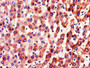 Immunohistochemistry of paraffin-embedded human liver tissue using CAC10978 at dilution of 1:100