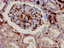 Immunohistochemistry analysis of human kidney tissue using CAC10992 at dilution of 1:100