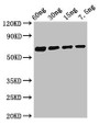 Western Blot; Positive WB detected in Recombinant protein; All lanes: Major allergen Bla g 1.0101 antibody at 2.8µg/ml; Secondary; Goat polyclonal to rabbit IgG at 1/50000 dilution; Predicted band size: 62 kDa; Observed band size: 62 kDa