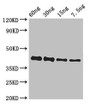 Western Blot; Positive WB detected in Recombinant protein; All lanes: GP antibody at 3µg/ml; Secondary; Goat polyclonal to rabbit IgG at 1/50000 dilution; predicted band size: 42 kDa; observed band size: 42 kDa;