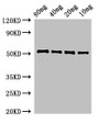 Western Blot; Positive WB detected in Recombinant protein; All lanes: pbpE antibody at 3µg/ml; Secondary; Goat polyclonal to rabbit IgG at 1/50000 dilution; Predicted band size: 52 kDa; Observed band size: 52 kDa;