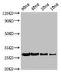 Western Blot; Positive WB detected in Recombinant protein; All lanes: PHLPII antibody at 2.8µg/ml; Secondary; Goat polyclonal to rabbit IgG at 1/50000 dilution; Predicted band size: 27 kDa; Observed band size: 27 kDa