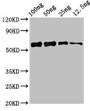 Western Blot; Positive WB detected in Recombinant protein; All lanes: ald1 antibody at 2.4µg/ml; Secondary; Goat polyclonal to rabbit IgG at 1/50000 dilution; predicted band size: 57 kDa; observed band size: 57 kDa;