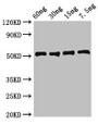 Western Blot; Positive WB detected in Recombinant protein; All lanes: ldh1 antibody at 2.7µg/ml; Secondary; Goat polyclonal to rabbit IgG at 1/50000 dilution; Predicted band size: 51 kDa; Observed band size: 51 kDa