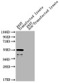 Western Blot; Positive WB detected in: eta 293T Transfected lysate, 293T non-Transfected lysate; All lanes: eta antibody at 1:2000; Secondary; Goat polyclonal to rabbit IgG at 1/50000 dilution; Predicted band size: 55 kDa; Observed band size: 55 kDa;