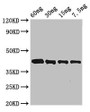 Western Blot; Positive WB detected in Recombinant protein; All lanes: Arginine esterase antibody at 3µg/ml; Secondary; Goat polyclonal to rabbit IgG at 1/50000 dilution; predicted band size: 42 kDa; observed band size: 42 kDa