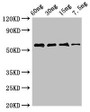 Western Blot; Positive WB detected in Recombinant protein; All lanes: AK antibody at 2.8µg/ml; Secondary; Goat polyclonal to rabbit IgG at 1/50000 dilution; Predicted band size: 55 kDa; Observed band size: 55 kDa