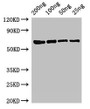 Western Blot; Positive WB detected in Recombinant protein; All lanes: mutL antibody at 3µg/ml; Secondary; Goat polyclonal to rabbit IgG at 1/50000 dilution; predicted band size: 68 kDa; observed band size: 68 kDa;