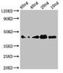 Western Blot; Positive WB detected in Recombinant protein; All lanes: Cobra venom factor antibody at 3µg/ml; Secondary; Goat polyclonal to rabbit IgG at 1/50000 dilution; predicted band size: 45 kDa; observed band size: 45 kDa
