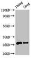 Western Blot; Positive WB detected in Recombinant protein; All lanes: MALD3 antibody at 3.2µg/ml; Secondary; Goat polyclonal to rabbit IgG at 1/50000 dilution; predicted band size: 26 kDa; observed band size: 26 kDa;