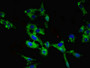 Immunofluorescent analysis of Hela cells using CAC11061 at dilution of 1:100 and Alexa Fluor 488-congugated AffiniPure Goat Anti-Rabbit IgG(H+L)