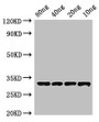 Western Blot; Positive WB detected in Recombinant protein; All lanes: Beta-lactamase inhibitory protein antibody at 4µg/ml; Secondary; Goat polyclonal to rabbit IgG at 1/50000 dilution; Predicted band size: 33 kDa; Observed band size: 33 kDa