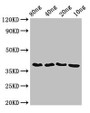 Western Blot; Positive WB detected in Recombinant protein; All lanes: ftsZ antibody at 3.5µg/ml; Secondary; Goat polyclonal to rabbit IgG at 1/50000 dilution; predicted band size: 39 kDa; observed band size: 39 kDa;