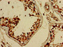 Immunohistochemistry of paraffin-embedded human testis tissue using CAC11104 at dilution of 1:100