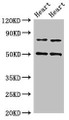 Western Blot; Positive WB detected in: Rat heart tissue, Mouse heart tissue; All lanes: Acss2 antibody at 4µg/ml; Secondary; Goat polyclonal to rabbit IgG at 1/50000 dilution; Predicted band size: 79 kDa; Observed band size: 79, 50 kDa;