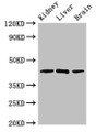 Western Blot; Positive WB detected in: Mouse kidney tissue, Rat liver tissue, Rat brain tissue; All lanes: KLF12 antibody at 2.5µg/ml; Secondary; Goat polyclonal to rabbit IgG at 1/50000 dilution; Predicted band size: 45, 29, 34 kDa; Observed band size: 45 kDa;