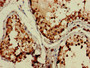 Immunohistochemistry of paraffin-embedded human testis tissue using CAC11116 at dilution of 1:100