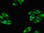Immunofluorescent analysis of HepG2 cells using CAC11116 at dilution of 1:100 and Alexa Fluor 488-congugated AffiniPure Goat Anti-Rabbit IgG(H+L)