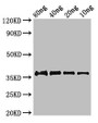 Western Blot; Positive WB detected in Recombinant protein; All lanes: fbpC antibody at 2.8µg/ml; Secondary; Goat polyclonal to rabbit IgG at 1/50000 dilution; Predicted band size: 37 kDa; Observed band size: 37 kDa