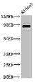 Western Blot; Positive WB detected in: Mouse kidney tissue; All lanes: CDH18 antibody at 2.4µg/ml; Secondary; Goat polyclonal to rabbit IgG at 1/50000 dilution; Predicted band size: 89, 64 kDa; Observed band size: 89 kDa;