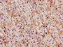 Immunohistochemistry of paraffin-embedded human adrenal gland tissue using CAC11131 at dilution of 1:100