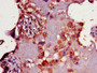 IHC image diluted at 1:300 and staining in paraffin-embedded human placenta tissue performed on a Leica BondTM system. After dewaxing and hydration, antigen retrieval was mediated by high pressure in a citrate buffer (pH 6.0). Section was blocked with 10% normal goat serum 30min at RT. Then primary antibody (1% BSA) was incubated at 4°C overnight. The primary is detected by a biotinylated secondary antibody and visualized using an HRP conjugated SP system. IHC image diluted at 1:300 and staining in paraffin-embedded human placenta tissue performed on a Leica BondTM system. After dewaxing and hydration, antigen retrieval was mediated by high pressure in a citrate buffer (pH 6.0). Section was blocked with 10% normal goat serum 30min at RT. Then primary antibody (1% BSA) was incubated at 4°C overnight. The primary is detected by a biotinylated secondary antibody and visualized using an HRP conjugated SP system.