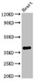 Western Blot; Positive WB detected in: Mouse heart tissue; All lanes: TNMD antibody at 2.8µg/ml; Secondary; Goat polyclonal to rabbit IgG at 1/50000 dilution; Predicted band size: 38, 24, 31 kDa; Observed band size: 38 kDa;
