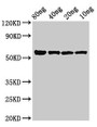 Western Blot; Positive WB detected in Recombinant protein; All lanes: kgp antibody at 3µg/ml; Secondary; Goat polyclonal to rabbit IgG at 1/50000 dilution; Predicted band size: 56 kDa; Observed band size: 56 kDa