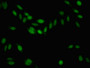 Immunofluorescent analysis of Hela cells using CAC11150 at dilution of 1:100 and Alexa Fluor 488-congugated AffiniPure Goat Anti-Rabbit IgG(H+L)
