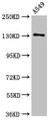 Western Blot; Positive WB detected in: A549 whole cell lysate; All lanes: EGFR antibody at 2.5µg/ml; Secondary; Goat polyclonal to rabbit IgG at 1/50000 dilution; Predicted band size: 135, 45, 78, 70 kDa; Observed band size: 135 kDa;