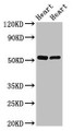 Western Blot; Positive WB detected in: Rat heart tissue, Mouse heart tissue; All lanes: SHE antibody at 2.5µg/ml; Secondary; Goat polyclonal to rabbit IgG at 1/50000 dilution; Predicted band size: 54 kDa; Observed band size: 54 kDa;